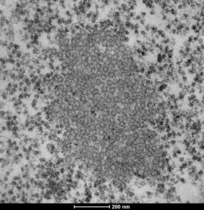 hNoV VLP assembly in Sf9 cells