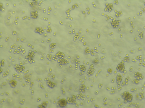 adenovirus propagation in HEK293T cells