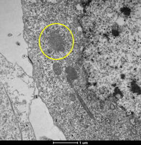 hNoV VLP assembly in Sf9 cells